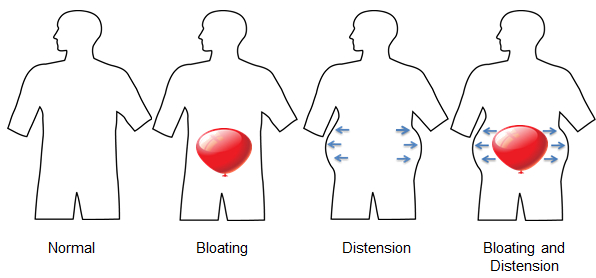 Tips For Preventing Bloating and Gas After Meals 1 Illustration showing stages of Stomach Bloating and Gas diagram
